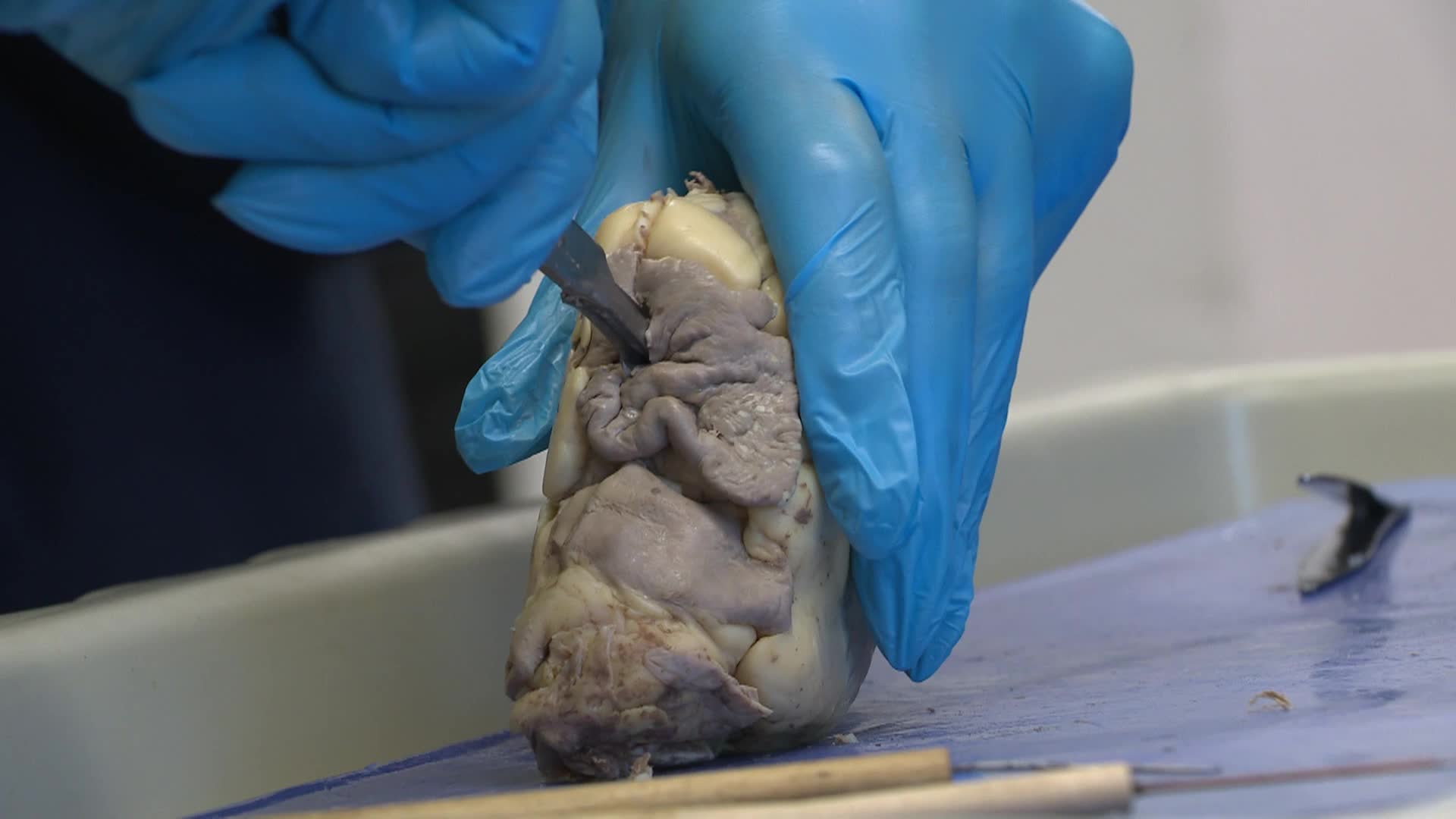 Thumbnail image for BHHS Life Science Promo